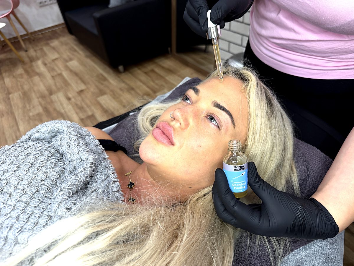 Chemical peel course