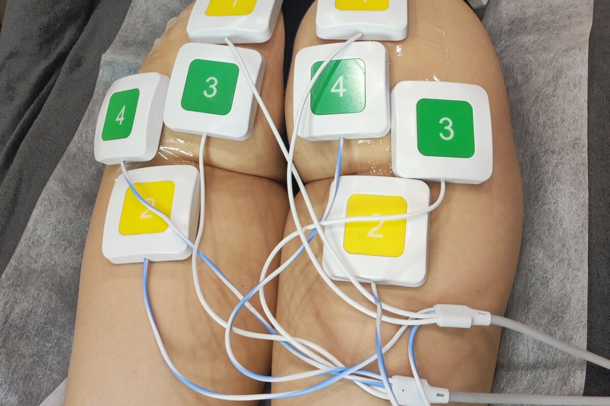 Dr.Nek EMS