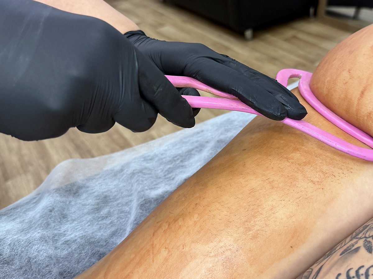 Kurz Ice & Metal Therapy